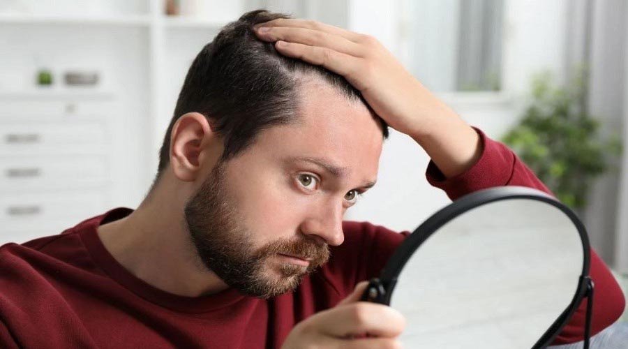 মানসিক চাপেও কি চুল পড়ে? বিষয়টি আসলে কি?